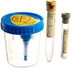 BD Vacutainer Urine Specimen Collection Kit