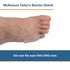 McKesson Tailor's Bunion Shield